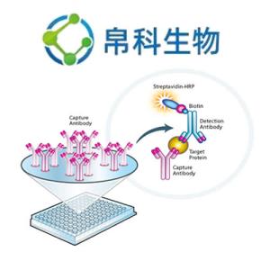 Oncostatin-M-specific receptor subunit beta ELISA Kit